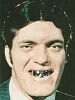 dentier